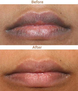  /storage/photos/1/Products/lip/lip3.jpg